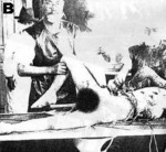Autopsy being performed on a Japanese civilian victim of the Jinan Incident, Jinan, Shandong, China, circa 3 May 1928, photo 2 of 3
