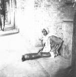 Elephantiasis nostras sufferer, Calcutta, India, late 1944